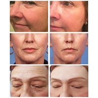 إزالة التجاعيد الفورية مصل الريتينول رفع ثبات مكافحة الشيخوخة جوهر تتلاشى الخطوط الدقيقة تبييض الوجه العناية بالبشرة كوريا مستحضرات التجميل - Image 2